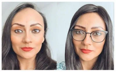 Does a Hair Patch Look Natural? A Complete Guide