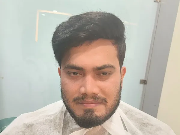 Client-0 - After