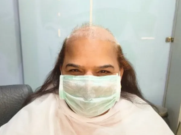 Client-8 - Before