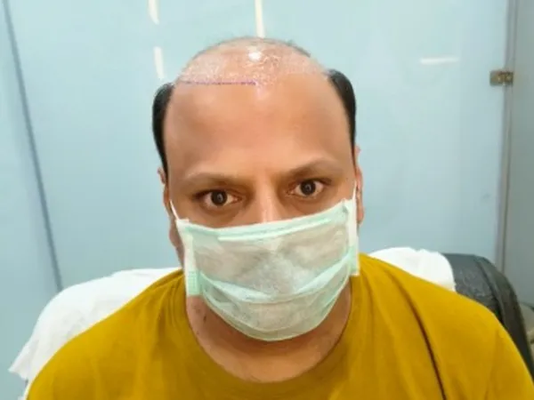 Client-15 - Before