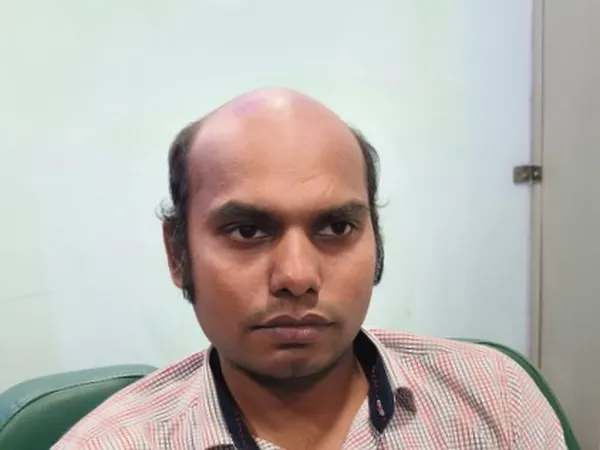 Client-1 - Before