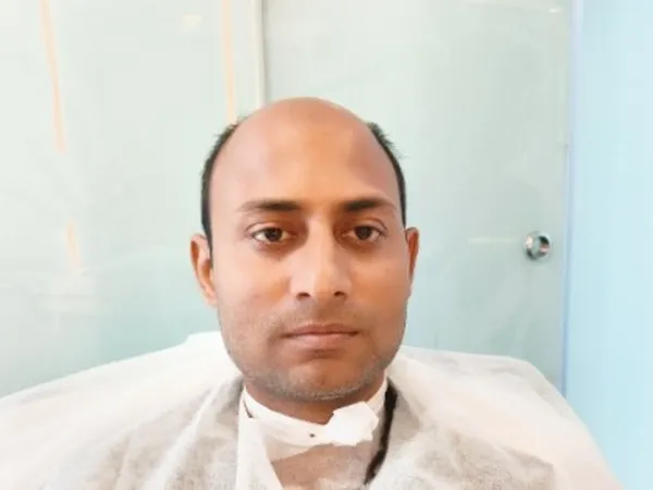 Client-18 - Before